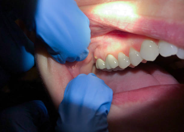 Best Walk-In Emergency Dentist in Morrisville, PA